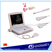 veterinary laptop ultrasound scanner